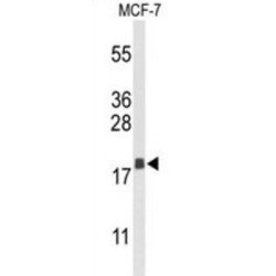 Anterior Gradient Protein 3 (AGR3) Antibody