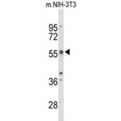 Tandem C2 Domains Nuclear Protein (TAC2N) Antibody
