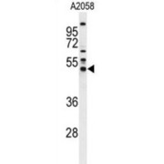 abx034372