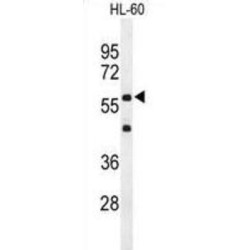 Interleukin 2 Receptor, Gamma (IL2RG) Antibody