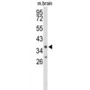 Interleukin 2 Receptor, Gamma (IL2RG) Antibody