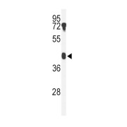 Beta-1,4-Galactosyltransferase 2 (B4GALT2) Antibody