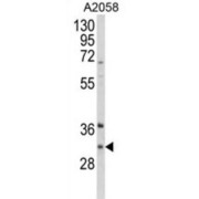 Inhibitor of Growth Protein 5 (ING5) Antibody
