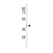 Acyl-CoA Dehydrogenase Family Member 8 (ACAD8) Antibody