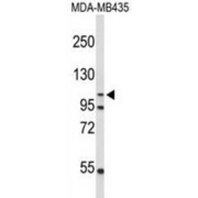 Flap Endonuclease GEN Homolog 1 (GEN1) Antibody
