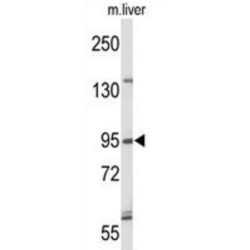 Flap Endonuclease GEN Homolog 1 (GEN1) Antibody