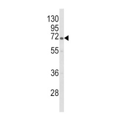 1,4-Alpha-Glucan-Branching Enzyme (GBE1) Antibody