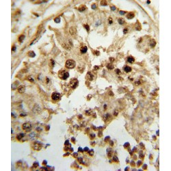 Testosterone 17-Beta-Dehydrogenase 3 (HSD17B3) Antibody