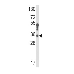 Testosterone 17-Beta-Dehydrogenase 3 (HSD17B3) Antibody