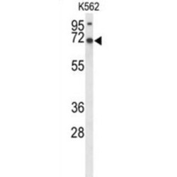 Leucine-Rich Repeat-Containing Protein 4 (LRRC4) Antibody