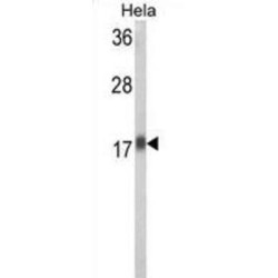 Ribosomal Protein L31 (RPL31) Antibody