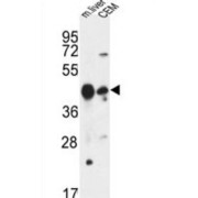 Phospholipase A1 Member A (PLA1A) Antibody