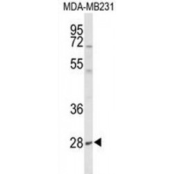 Protein YIPF5 (YIPF5) Antibody