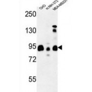 SH3-Containing GRB2-Like Protein 3-Interacting Protein 1 (SGIP1) Antibody