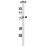 Phosphatidylinositol-3-Phosphatase SAC1 (SACM1L) Antibody