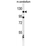 Kinesin-Like Protein KIF6 (KIF6) Antibody