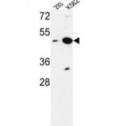 abx034427