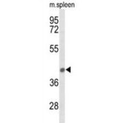 Peroxisome Assembly Protein 12 (PEX12) Antibody