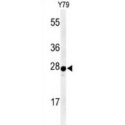 Serotonin N-Acetyltransferase (AANAT) Antibody