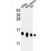 Ribosomal Protein L36 (RPL36) Antibody