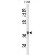 Pyruvate Dehydrogenase E1 Component Subunit Alpha, Somatic Form, Mitochondrial (PDHA1) Antibody