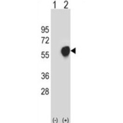 Pyruvate Dehydrogenase E1 Component Subunit Alpha, Somatic Form, Mitochondrial (PDHA1) Antibody