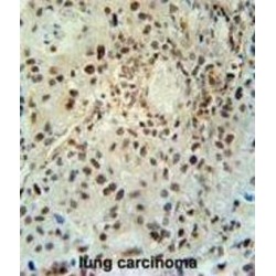 Protein ABHD14B (ABHEB) Antibody