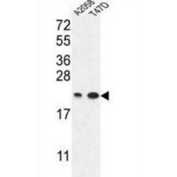 Protein ABHD14B (ABHEB) Antibody