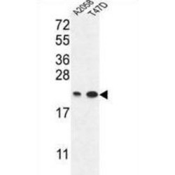 Protein ABHD14B (ABHEB) Antibody