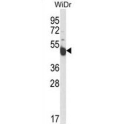 Protein Inscuteable Homolog (INSC) Antibody