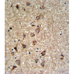 Solute Carrier Family 25 Member 37 (SLC25A37) Antibody