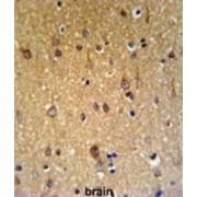 Palmitoyltransferase ZDHHC9 (ZDHHC9) Antibody