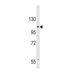 Calcium Voltage-Gated Channel Auxiliary Subunit Alpha2delta 3 (CACNA2D3) Antibody