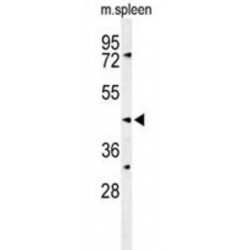 Phosphatidylcholine (SGMS2) Antibody