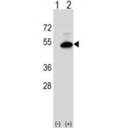 Phosphatidylcholine (SGMS2) Antibody