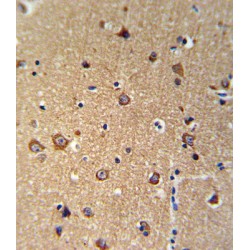 Progressive Ankylosis Protein Homolog (ANKH) Antibody