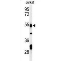 Protein Prune Homolog (PRUNE) Antibody