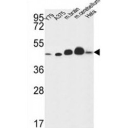 NADH Ubiquinone Oxidoreductase Core Subunit S2 (NDUFS2) Antibody