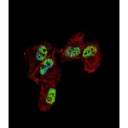 Zinc Finger Protein 202 (ZNF202) Antibody