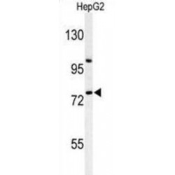 Zinc Finger Protein 202 (ZNF202) Antibody