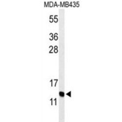 Progonadoliberin 2 (GNRH2) Antibody