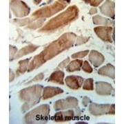 Methylmalonic Aciduria Type A Protein, Mitochondrial (MMAA) Antibody