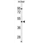 Cyclin-Dependent Kinase 14 (PFTK1) Antibody
