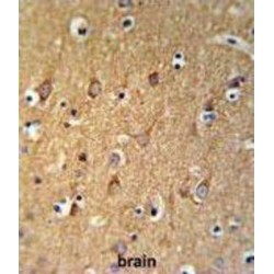 Phosphatidylcholine (SGMS2) Antibody
