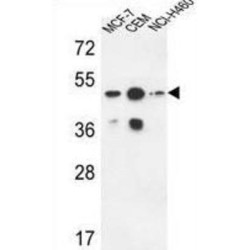 Phosphatidylcholine (SGMS2) Antibody
