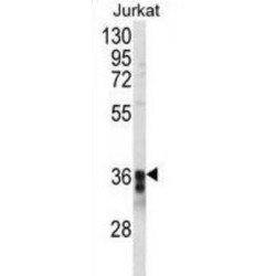 Transmembrane Protein 173 (TM173) Antibody