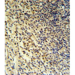 Platelet-Activating Factor Acetylhydrolase (PLA2G7) Antibody