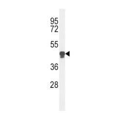 Platelet-Activating Factor Acetylhydrolase (PLA2G7) Antibody