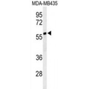 WB analysis of MDA-MB435 cell line lysates (35 µg).