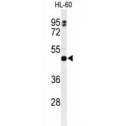 HLA Class II Histocompatibility Antigen, DR Beta 5 Chain (HLA-DRB5) Antibody